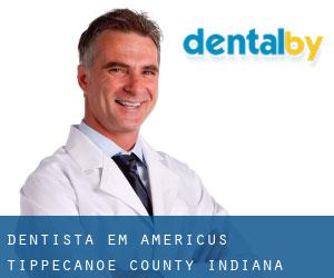 dentista em Americus (Tippecanoe County, Indiana)
